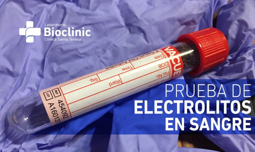 Electrolitos En Sangre Prueba De Laboratorio Centro Médico Santa Teresa 7610